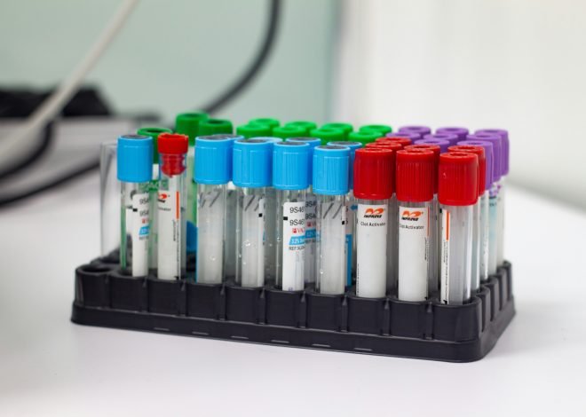 More Test Results and Questions