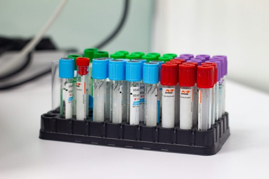 Row of transparent blood collection tubes with blue, red, green, and purple caps in a black rack on a lab bench.