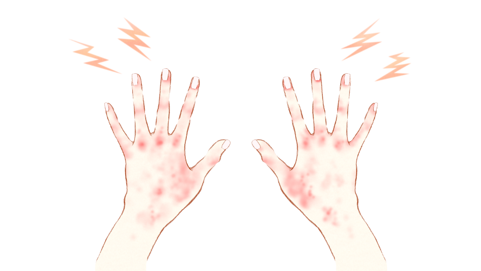 Hands are red and itchy